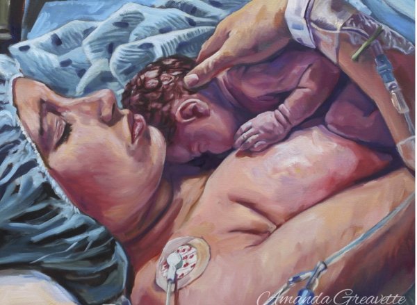 Беременность картина