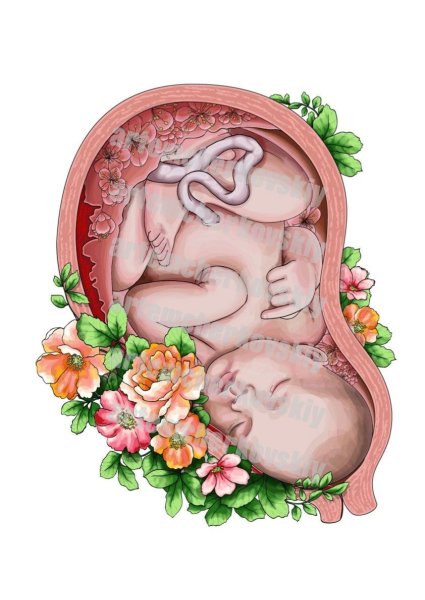 Дистоция плечиков прием Мак Робертса