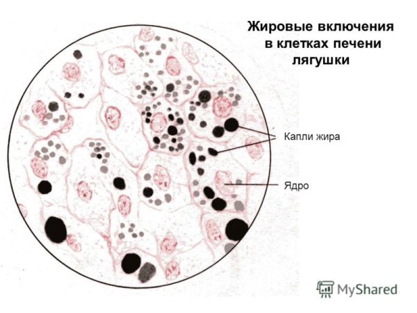 Включения жира в клетках печени