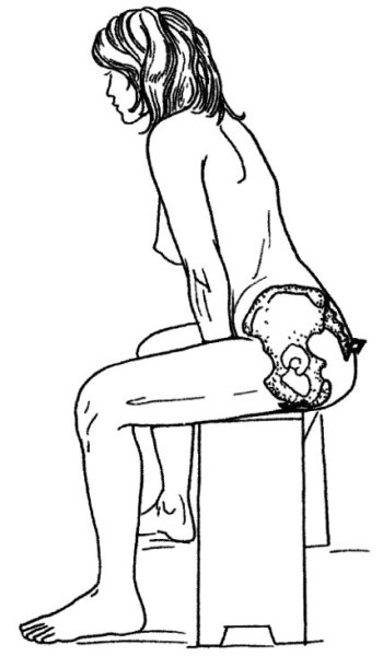 Упражнения для вправления таза