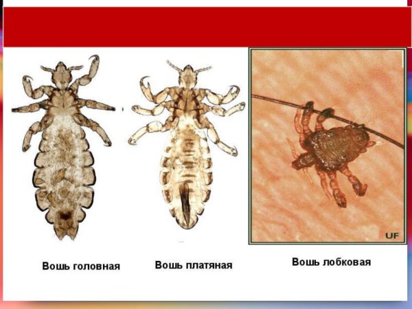 Платяная вошь отряд