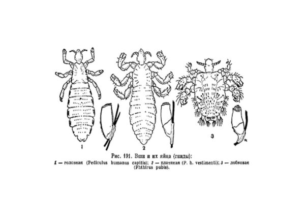 Платяная вошь строение