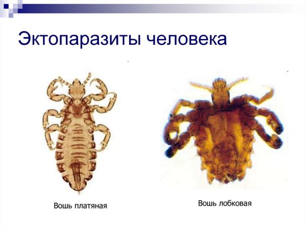 Головная вошь возбудитель тиф