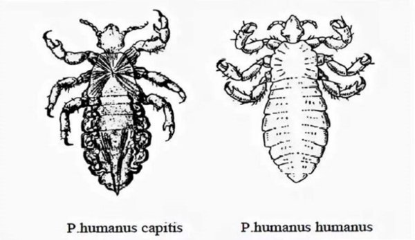 Pediculus humanus capitis строение