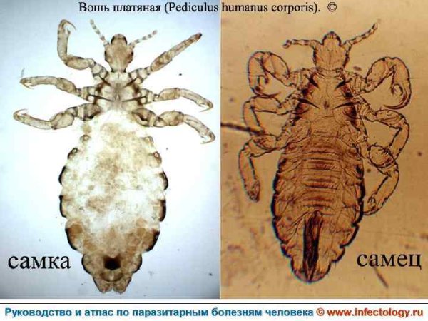 Вошь головная и платяная отличия