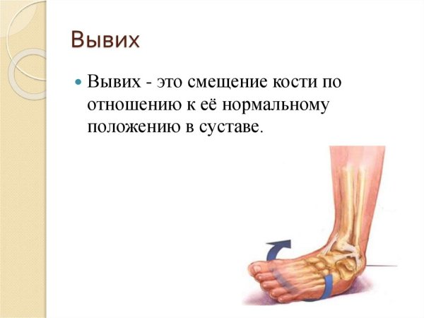 Положение головки плечевой кости при вывихах