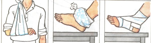 Вывих плечевого сустава травма