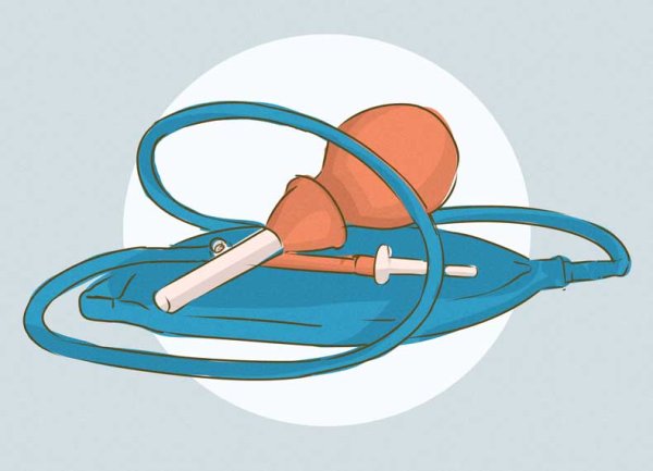 Очистительная клизма рисунок