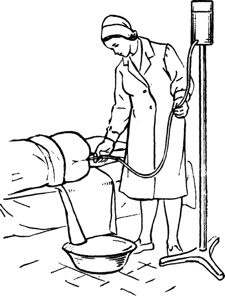 Постановка очистительной Клиз