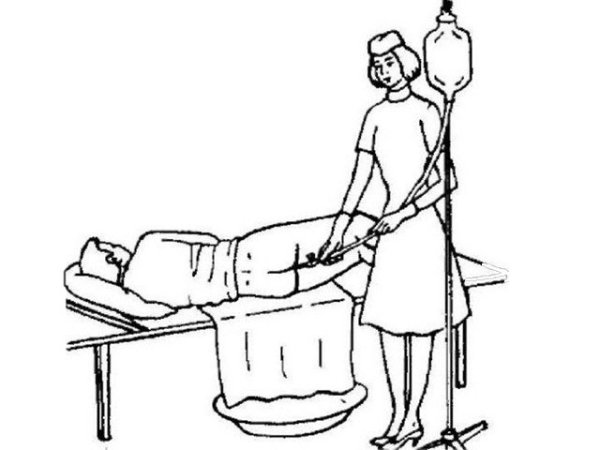 Очистительная клизма алгоритм