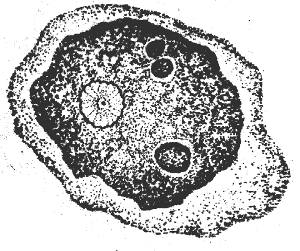 Дизентерийная амеба