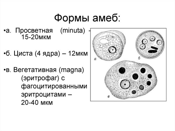 Большая вегетативная форма дизентерийной амёбы