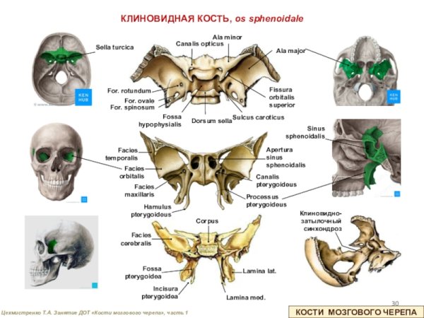 Клиновидная кость (os sphenoidale)