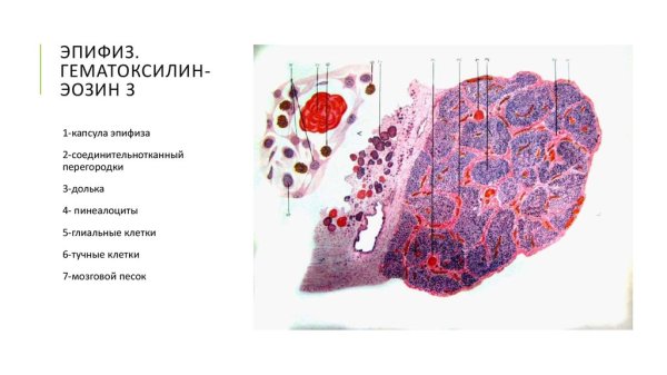 Эпифиз гистология препарат