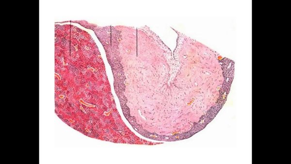 Гипофиз гистология препарат