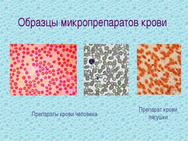 Микропрепарат крови лягушки