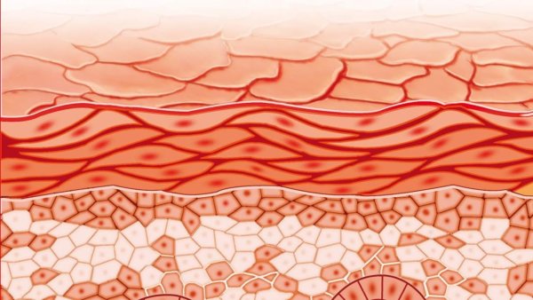Роговой слой кожи под микроскопом
