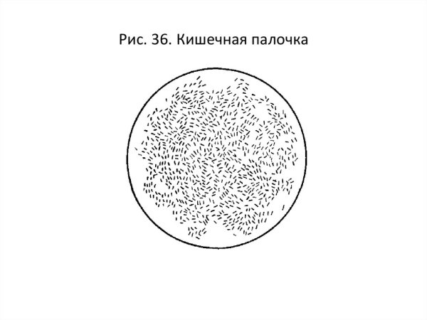 E coli рисунок