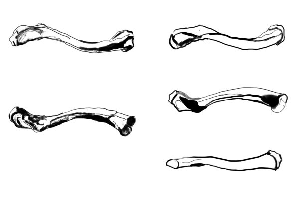 Ключицы пластическая анатомия