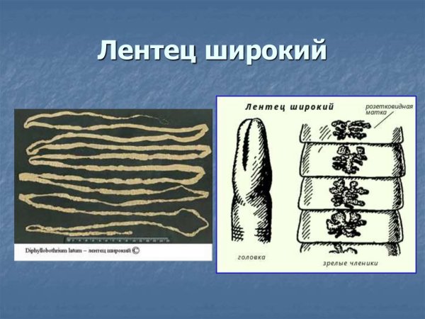 Сколекс широкого лентеца строение