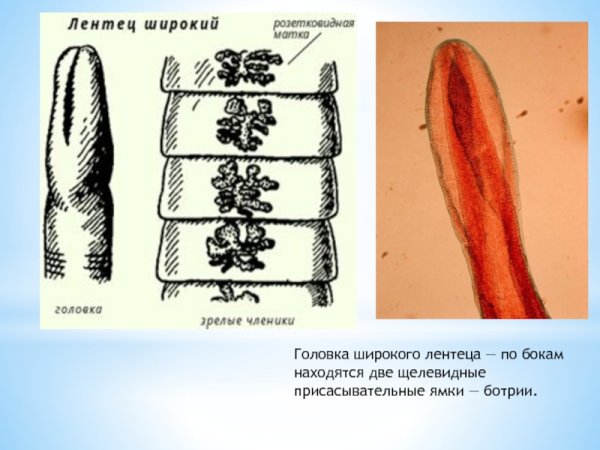 Сколекс широкого лентеца строение