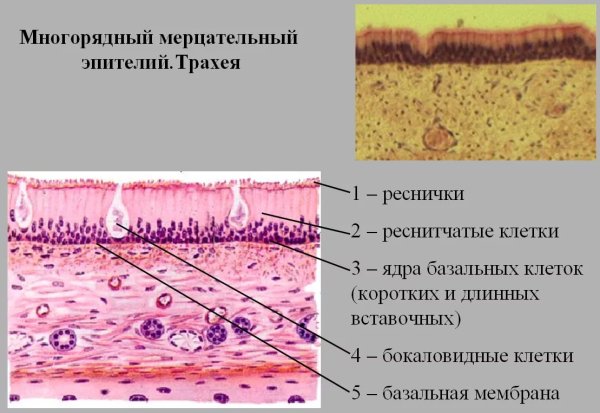 Trachea гистология