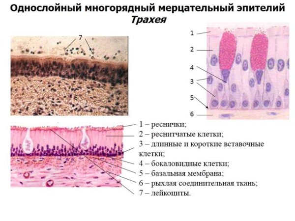 Трахея гистология препарат