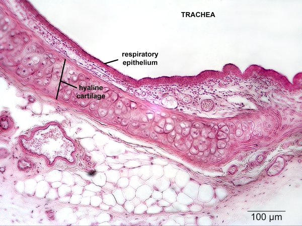 Строение слизистой оболочки бронхов гистология
