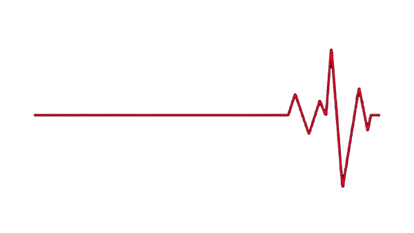 Линия кардиограммы