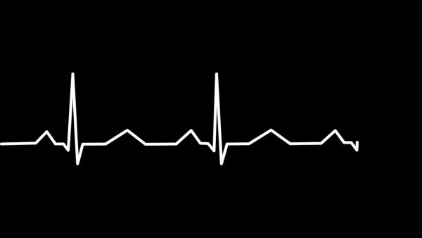 Линия сердцебиения