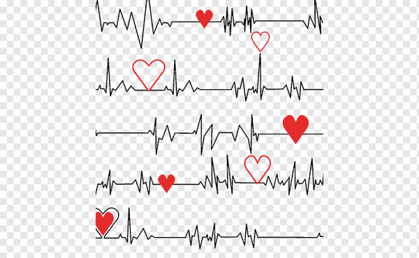 ЭКГ кардиограмма сердца