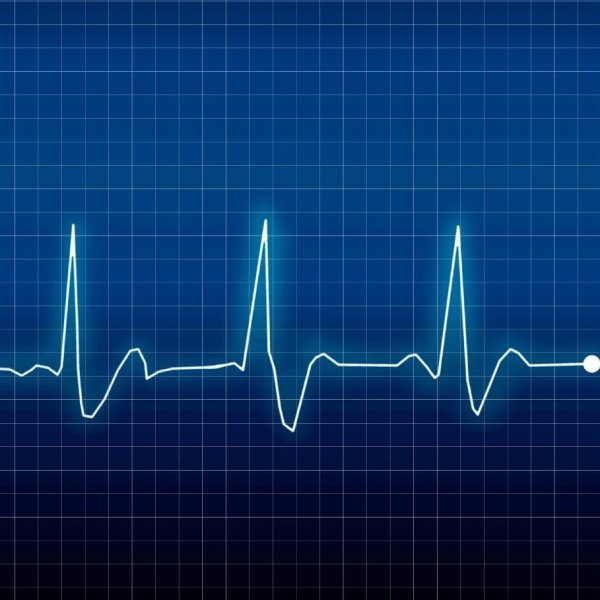 Ритм сердца