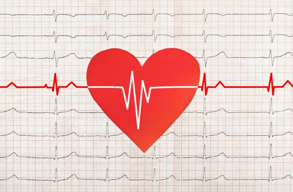 Красивая ЭКГ