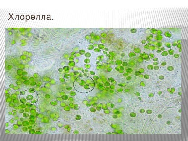 Пиреноид у хлореллы