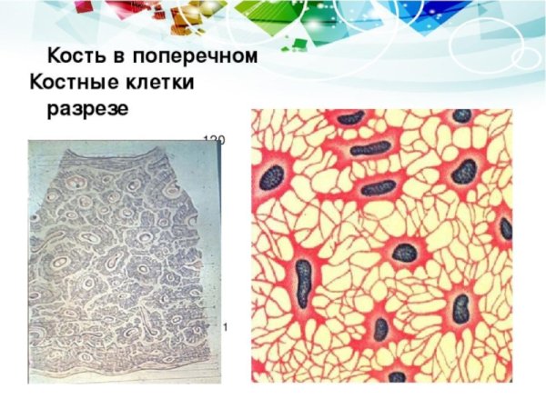 Костные клетки жаберной крышки селедки