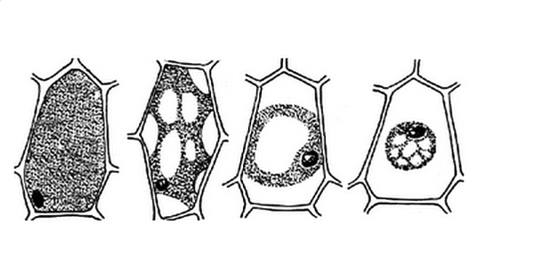 Формы плазмолиза растительных клеток