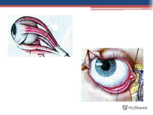 Глаз с нервами рисунок