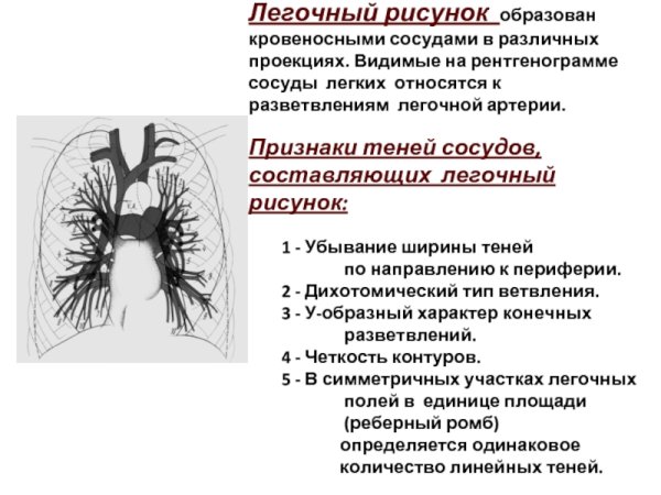 Анализ легочного рисунка