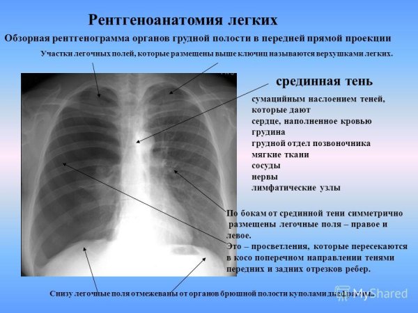 Рентгеноанатомия дыхательной системы
