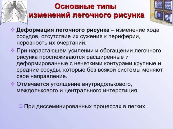 Ячеистая деформация легочного рисунка рентген