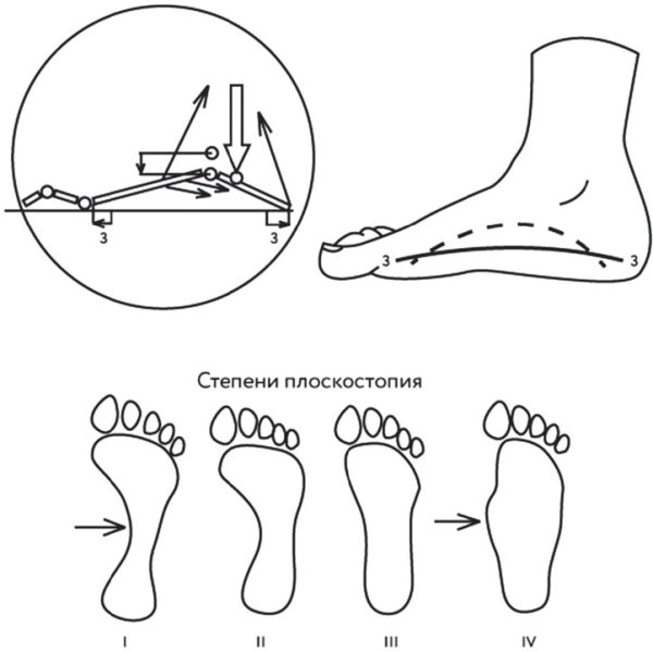 Методика профилактики плоскостопия у дошкольников