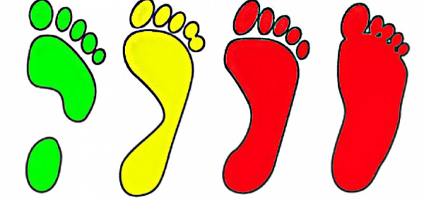 Отпечаток стопы 3 степени плоскостопия