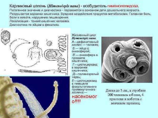 Гименолепидоз карликовый цепень