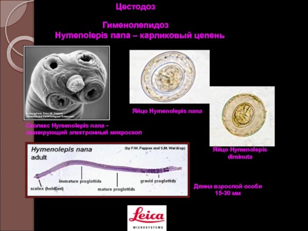 Карликовый цепень (Hymenolepis Nana)