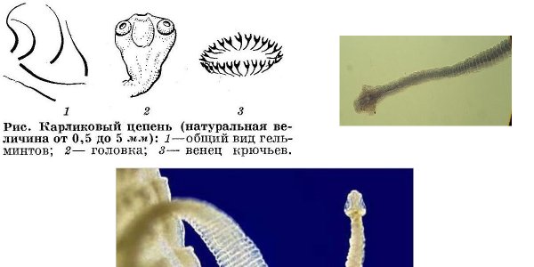 Hymenolepis Nana строение
