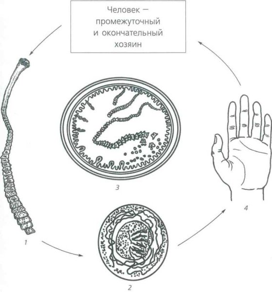 Гименолепидоз аутоинвазия