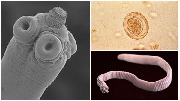 Гименолепидоз карликовый цепень