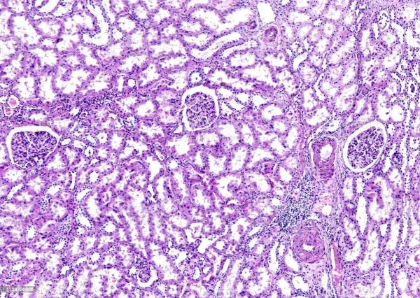 Препарат почки гистология микроскоп