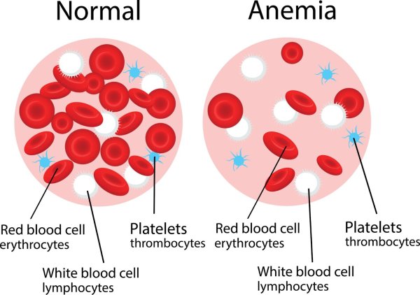 Blood Platelets normal