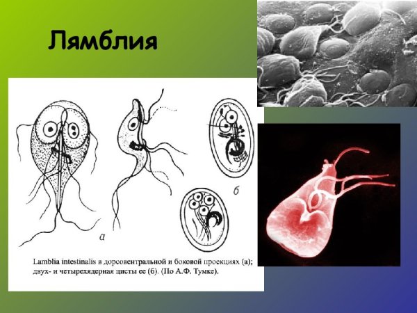 Многожгутиковые лямблии